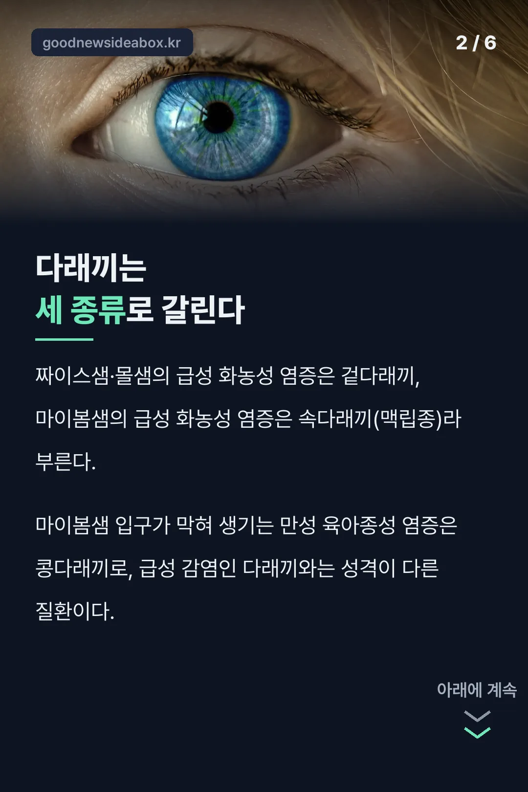 다래끼 세 종류